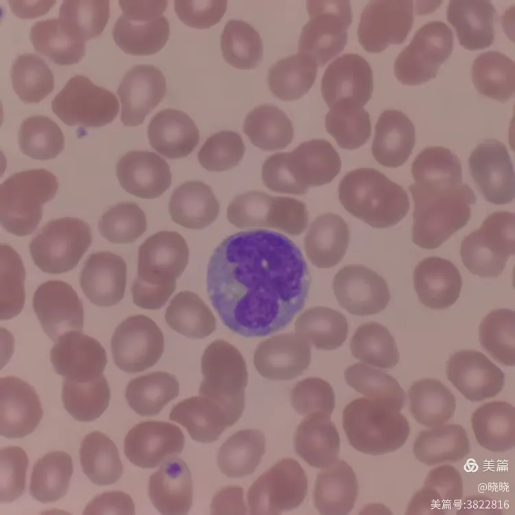 第一次见幼稚单核细胞